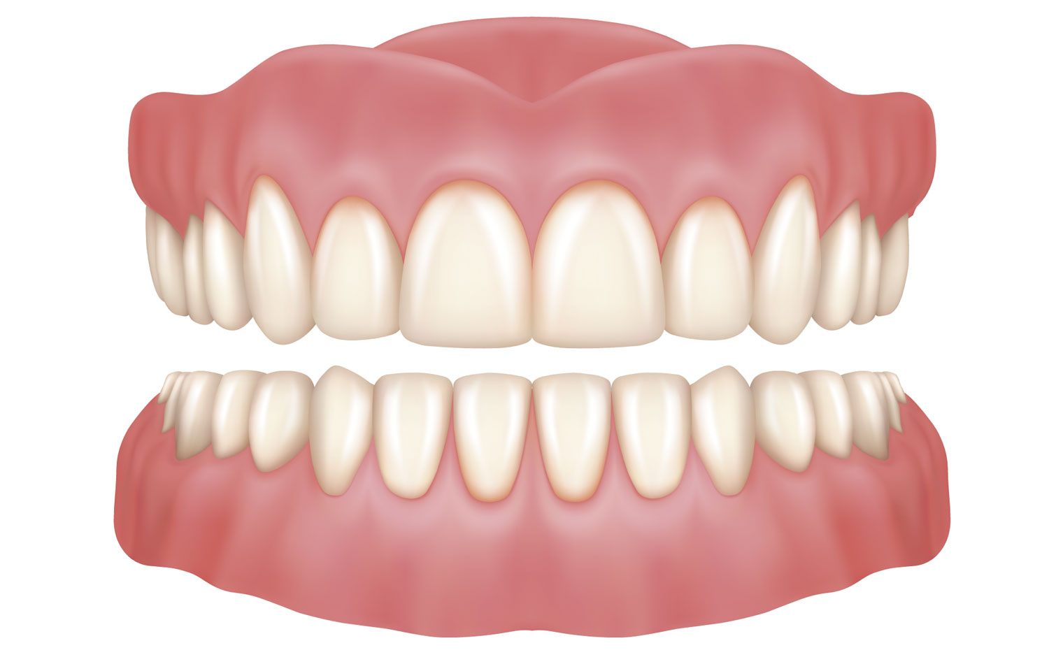 Partial and complete dentures